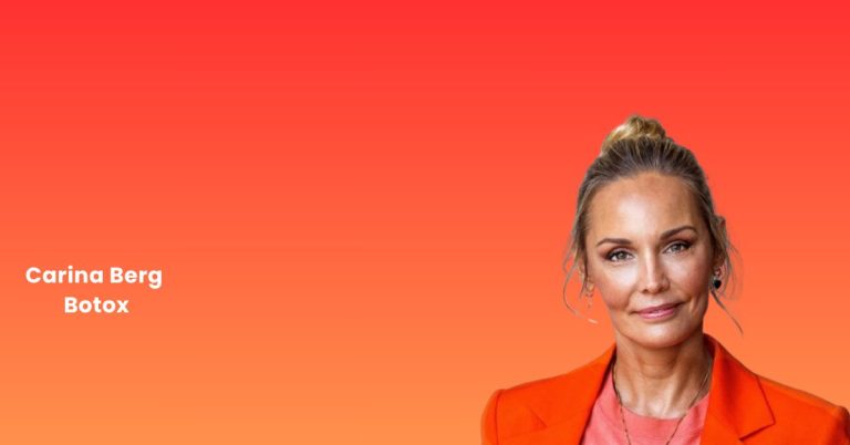 Carina Berg Botox 4 Carina Berg Botox